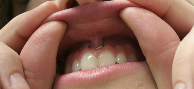 Courtney Kubayko's smiley piercing.